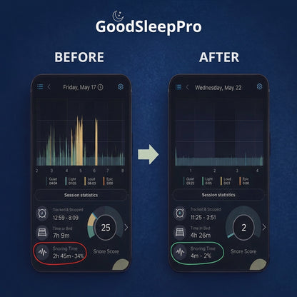 GoodSleep Pro - Anti -Snoring